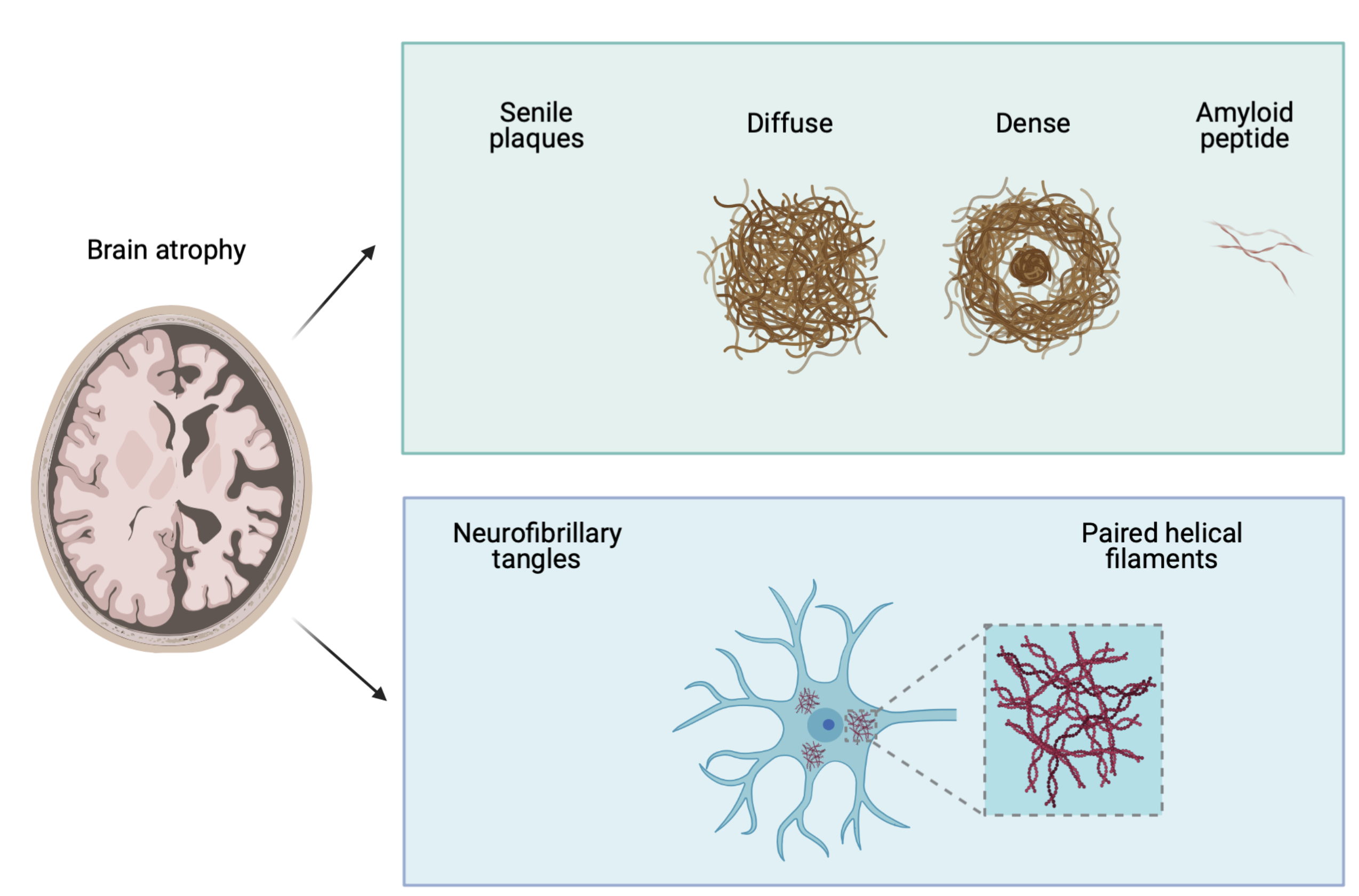 paired helical filaments